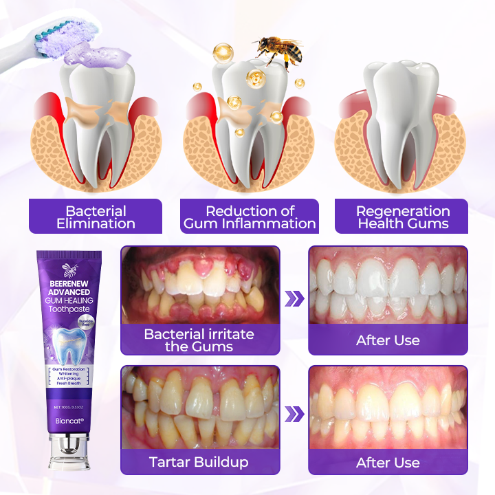 Biancat® BeeRenew Advanced Gum Healing Toothpaste👍