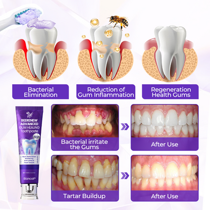 Biancat® BeeRenew Advanced Gum Healing Toothpaste👍