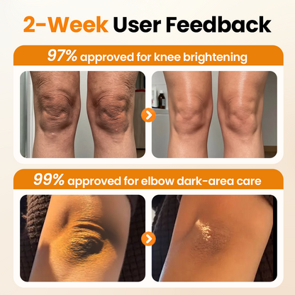 Biancat® AHA GlowPurify Body Cream