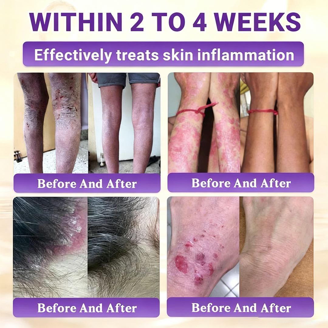 Timilk® BioColla DermaRenew Cream 👍