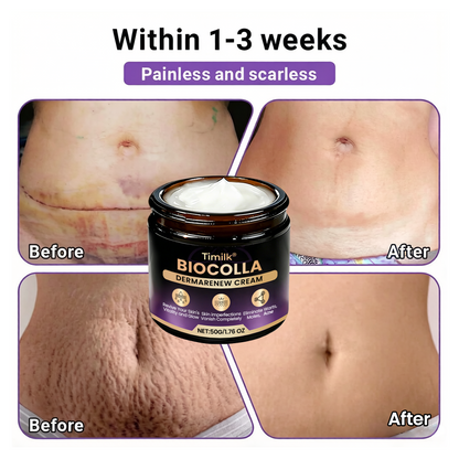 Timilk® BioColla DermaRenew Cream 👍