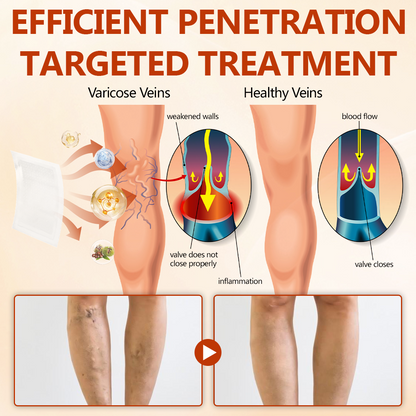 🦵Timilk® VeinRepair Microneedle Patch Roll👍