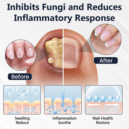 Ceoerty® NailFungiClear Pro Antifungal Pen