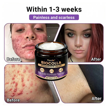 Timilk® BioColla DermaRenew Cream 👍