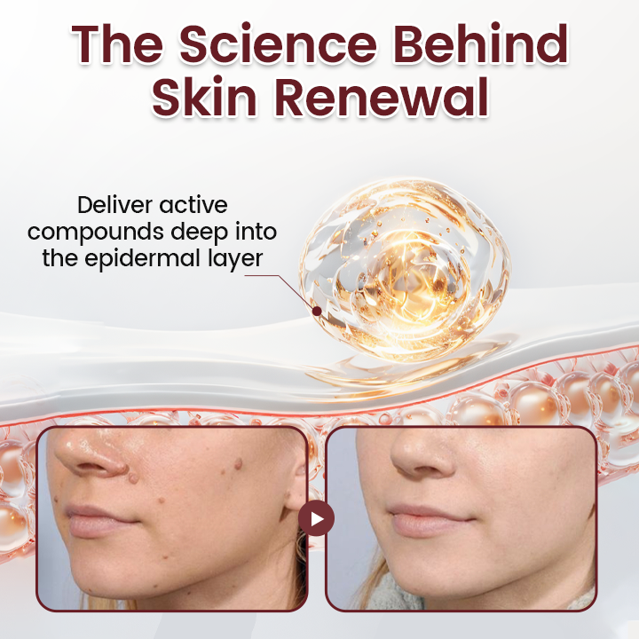 Timilk® BumpAway Gentle Renewal Cream👍