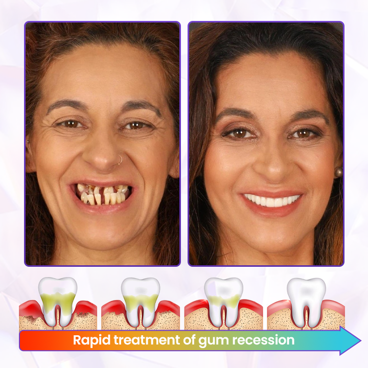 Biancat® BeeRenew Advanced Gum Healing Toothpaste👍