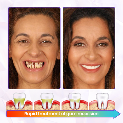 Biancat® BeeRenew Advanced Gum Healing Toothpaste👍