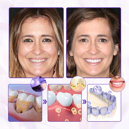 Biancat® BeeRenew Advanced Gum Healing Toothpaste👍