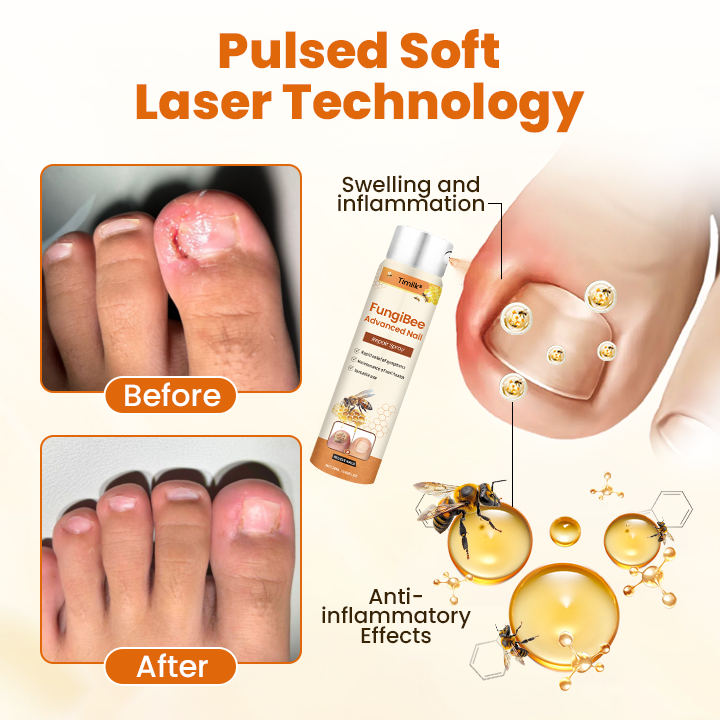 Timilk® FungiBee Advanced Nail Repair Spray