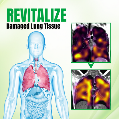 🚭 Biancat® RespiPure Herbal Lung Detox Spray 🌿 Herbal Breathing Spray for Smoke, Dust & Dry Air Exposure | Botanical Respiratory Support | Daily Fresh Air Routine